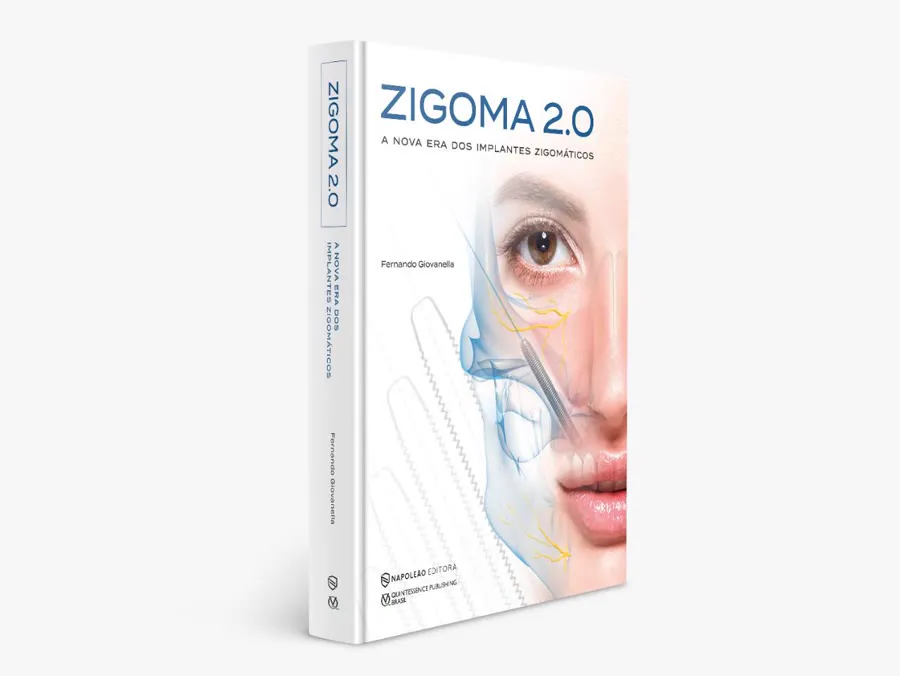 Livro Zygoma 2.0 — A Nova Era dos Implantes Zigomáticos, de Fernando Giovanella