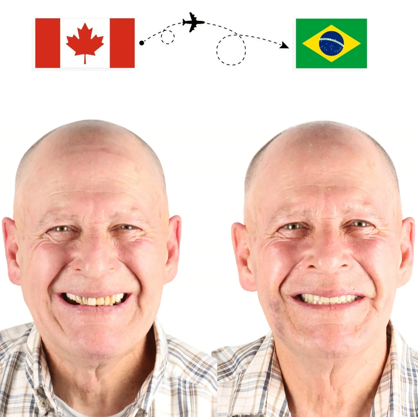 Antes e depois: paciente que veio do Canadá para o Brasil