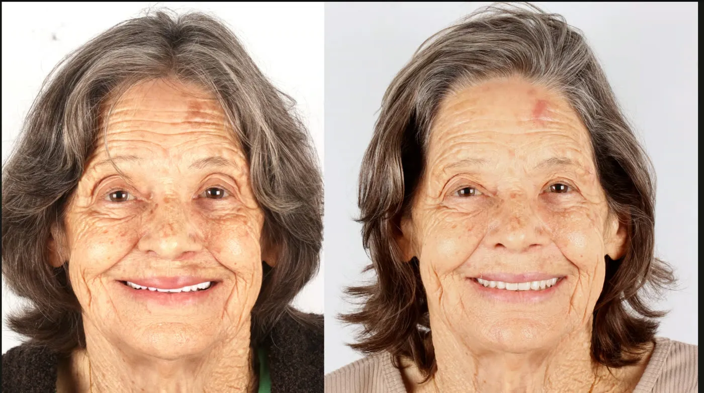 Antes e depois: o suporte do rosto recuperado com a abordagem FaceFirst